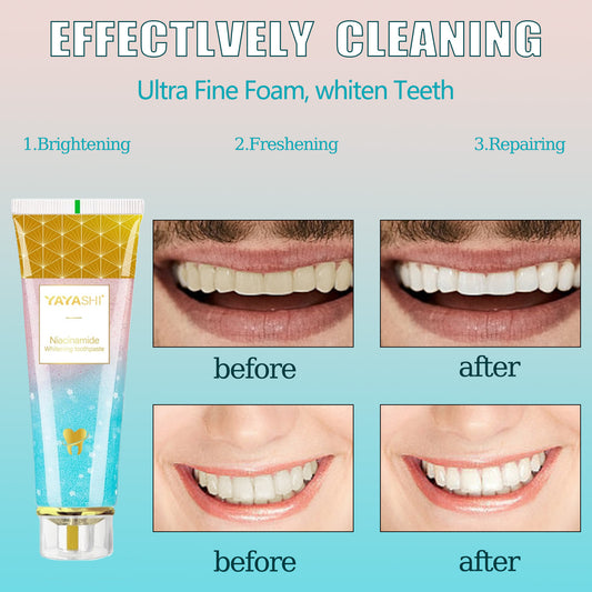 Niacinamide Whitening Toothpaste, YAYASHI Niacinamide Intensive Whitening Toothpaste with Natural Gentle Care Deep Stain Removal Cherry Blossom Mint Flavor, Improves Gum Health