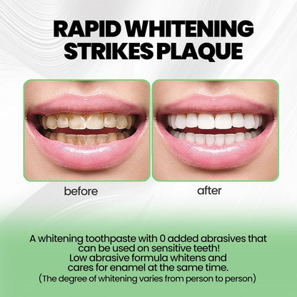 Hydroxyapatite Toothpastes 10%,Fluoride-Free Toothpaste, Gentle Mint, Fresh Breath, Daily Use for Oral Health 4.23oz